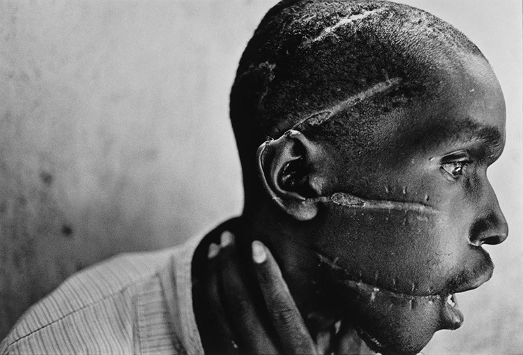 30-Years-World-Press-Photo-James-Nachtwey-1995.jpg