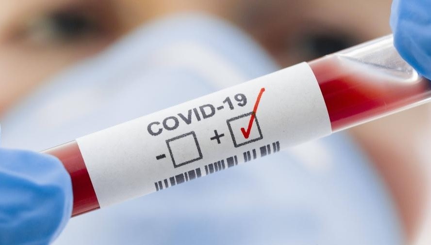 Covid19+.jpg Covid19+.jpg